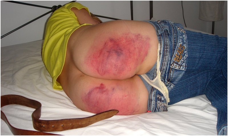 blonde with a very sore bottom curls up on her bed after a hard spanking with a leather belt